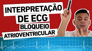 INTERPRETAÇÃO DE ECG Bloqueio atrioventricular e condutas [upl. by Elle]