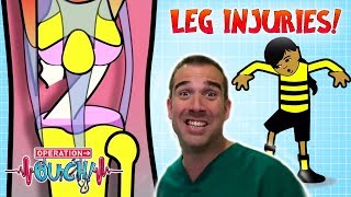 Leg Injuries  Ouch Alert  Operation Ouch  Science for Kids [upl. by Brynna]