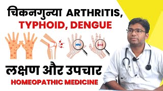 Chikungunya Arthritis Typhoid Dengue  लक्षण और उपचार  Homeopathic Medicine drneeraj [upl. by Langston]