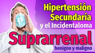 Hipertensión secundaria e Incidentalomas suprarrenales  Cap 98 y 99  Dr Mario Vega Carbó [upl. by Enahs441]