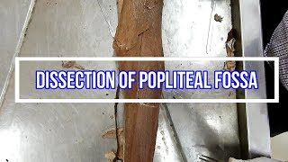 Dissection of Popliteal Fossa [upl. by Amyaj963]