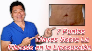 7 Puntos Claves Sobre la Fibrosis en la Liposucción [upl. by Artema643]