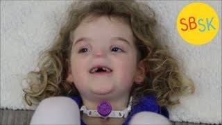 The Girl Born Without a Nose BAM Syndrome [upl. by Deane]