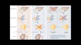 The Many Faces of Adrenal Insufficiency [upl. by Garbe]