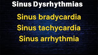 Sinus Dysrhythmias  Sinus bradycardia  Sinus tachycardia  Sinus arrhythmia [upl. by Earehc]