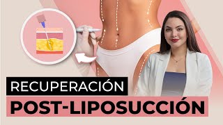 Liposucción Claves para EVITAR la FIBROSIS y prolongar los resultados [upl. by Aimac]