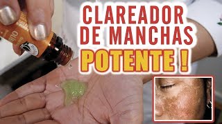 O mais Potente Clareador para ACABAR com MANCHAS NA PELE [upl. by Netty]