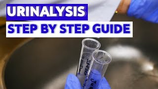 HOW TO DO URINALYSIS MEDICAL LABORATORY SCIENCE [upl. by Clair]