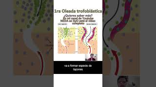 1ra Oleada trofoblástica PREECLAMPSIA [upl. by Nerro368]