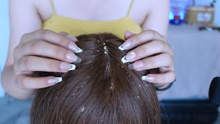 ASMR  Dandruff Removal amp Scalp Check Extremely Satisfying [upl. by Hendrik469]