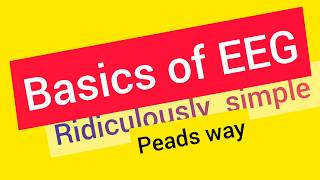 Basics of EEG interpretation [upl. by Ydnor]