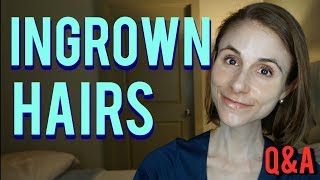 Ingrown hairs how to get rid of them amp skin care tips Dr Dray [upl. by Marlee]