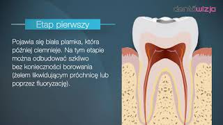 Jak powstaje próchnica [upl. by Nailij]