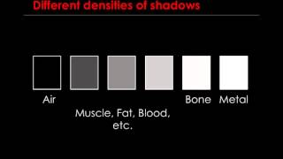 How to Interpret XRays the Basics [upl. by Maure]