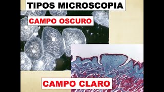 TIPOS DE MICROSCOPIA  CAMPO CLARO Y CAMPO OSCURO [upl. by Gotcher]