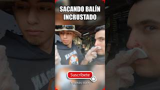 😱SACANDO BALÍN INCRUSTADO😱 ▬ CORRECTO PROCEDIMIENTO ▬ airsoft gameplay shorts [upl. by Nickie]