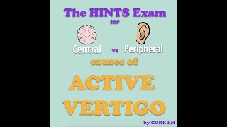 The HINTS Exam [upl. by Brockwell96]