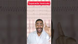 Taquicardia Ventricular ecg [upl. by Ribble848]