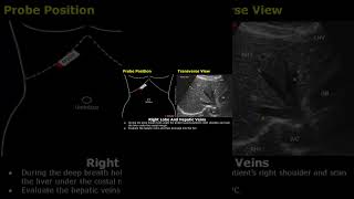 Right Liver Lobe amp Hepatic Veins Probe Positioning  Ultrasound Transducer Placement USG shorts [upl. by Cchaddie]