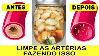 Esta Receita SUGA A GORDURA das Veias Igual Aspirador Suga Poeira [upl. by Anton660]