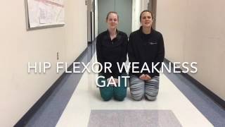 Hip Flexor Weakness Gait [upl. by Herahab363]