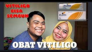 SEMBUHKAN VITILIGO DENGAN ELIDEL  part 26 [upl. by Akitahs]