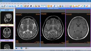 Sante DICOM Viewer  How to compare images of different series [upl. by Anitsyrhc840]