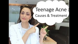 Teenage Acne causes amp treatment [upl. by Yelram]