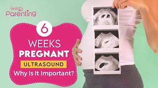 6 Weeks Pregnancy Ultrasound  Why Is It Important amp What to Expect [upl. by Loos]