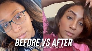 MICROSHADING VS MICROBLADING  MY EXPERIENCE amp HEALING PROCESS [upl. by Eiramac524]