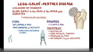 Legg Calve Perthes Disease Causes Symptoms Diagnosis amp Treatment Pathology [upl. by Bonina]