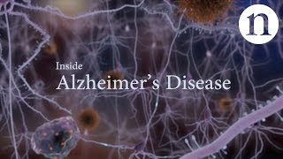 Part 8 Alzheimer´s Disease Proteins  like you´ve never seen them before [upl. by Einotna]