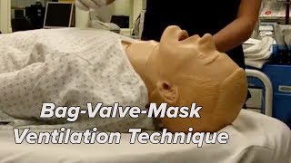 BagValveMask Ventilation Technique [upl. by Eocsor]