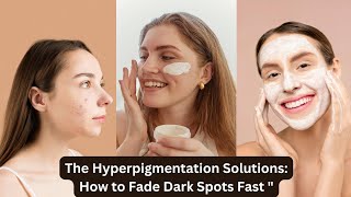 The Hyperpigmentation Solutions How to Fade Dark Spots Fast Hyperpigmentation Skincare DarkSpots [upl. by Behah669]