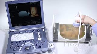 4D Ultrasound Training on Voluson and Other 4D Ultrasound Machines [upl. by Oesile]