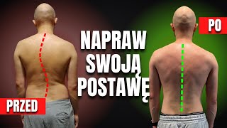 NAPRAW swoją POSTURĘ raz na Zawsze Na przykładzie Jarka [upl. by Lihp]