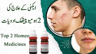 Top 2 Homeopathic Medicine for acne Acne treatment homeopathy  UrduHindi ایکنی کا ہومیوپیتھک علاج [upl. by Foote509]