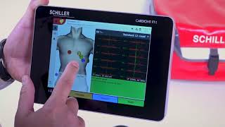 ECG SCHILLER Cardiovit FT1  Touchscreen ECG [upl. by Stedt184]