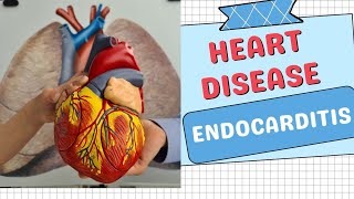 Endocarditis Disorders Types Symptoms Causes and Treatments Explained [upl. by Orlina]