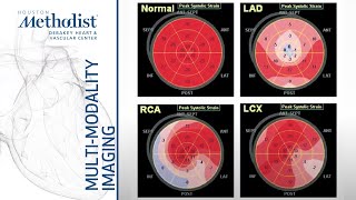 Role of Stress Echocardiography Ischemia Evaluation and Beyond M Quiñones MD December 15 2020 [upl. by Foster188]