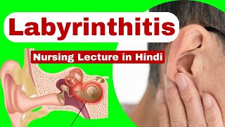 Labyrinthitis  causes symptoms management  medical surgical nursing  nursing lecture in hindi [upl. by Niels495]