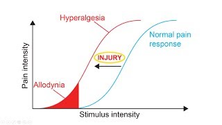 Hyperalgesia And Allodynia Explained  What is the definition of Hyperalgesia [upl. by Eibur]