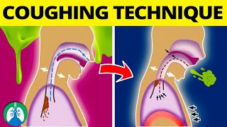 This COUGHING Technique Can Help Get Rid of Mucus and Phlegm ❗ [upl. by Oam]