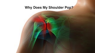 Why Does My Shoulder Snap and Pop [upl. by Tatman]