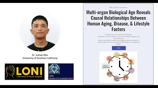 MultiOrgan Biological Age Reveals Causal Relationships Between Human AgingDiseaseampLifestyle Factors [upl. by Cost]