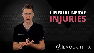 LINGUAL NERVE INJURIES IN DENTISTRY  OnlineExodontiacom [upl. by Oilut953]