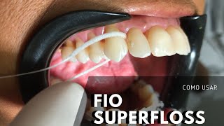 Como usar fio Superfloss da OralB  Dr Victor Hugo Almeida [upl. by Sandberg]