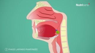 Dysphagie troubles de la déglutition et Fausse route questce que cest [upl. by Aihtniroc]