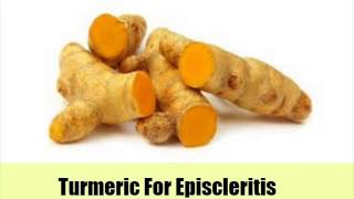 9 Top Natural Cures For Episcleritis [upl. by Goodard127]