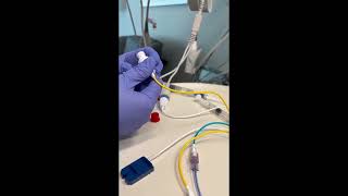 Connecting your SwanGanz catheter to the Hemosphere [upl. by Studdard]